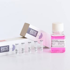 SARS-COV-Diagnostic-kits