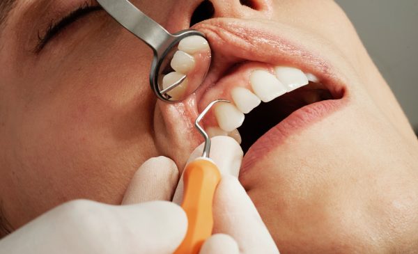 استخدام دستیار دندانپزشک جردن