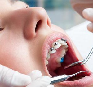 استخدام دستیار دندانپزشک ظفر