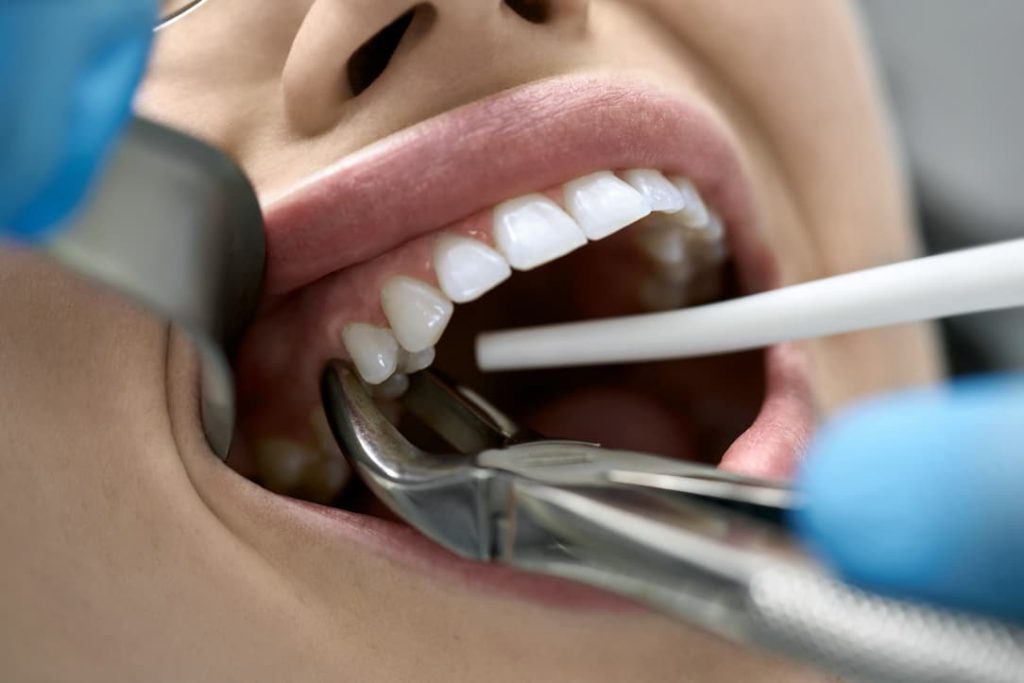 نیازمند دندانپزشک عسلویه