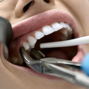 نیازمند دندانپزشک عسلویه