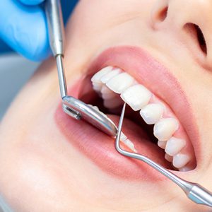 نیازمند دندانپزشک عمومی با درآمد میانگین ۵۰ تا ۱۰۰ میلیون‌ تومان