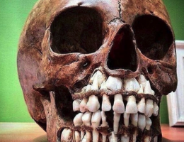 تصویری شگفت انگیز از دندان های شیری