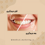 طراحی پست اینستاگرام ویژه دندانپزشکان